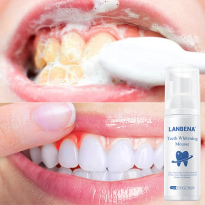 ✨ Mousse de Blanchiment des Dents LANBENA – Sourire Éclatant &amp; Haleine Fraîche